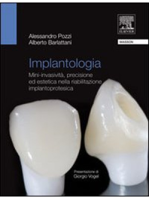 Implantologia. Mini-invasiv...