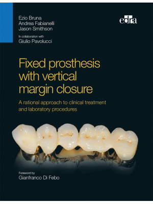 Fixed prosthesis with verti...