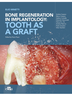 Bone regeneration in implan...