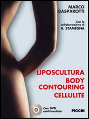 Liposcultura body contourin...