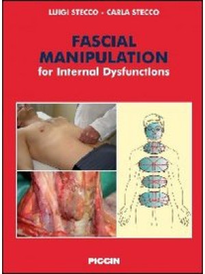 Fascial manipulation for in...