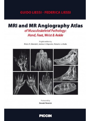 MRI and MR angiography atla...