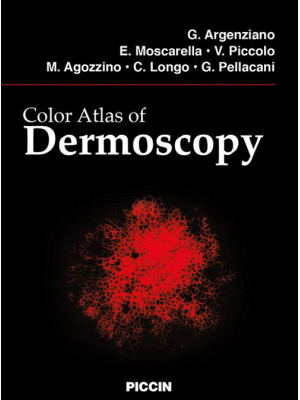 Color atlas of dermoscopy