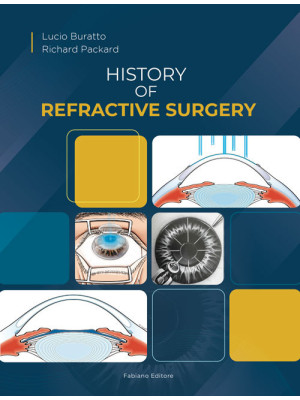 History of refractive surgery