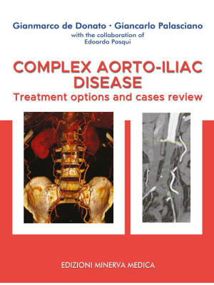 Complex aorto-iliac disease...