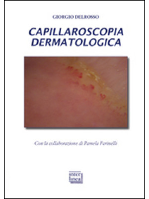 Capillaroscopia dermatologica