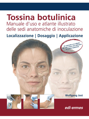 Tossina botulinica. Manuale...