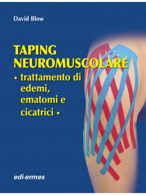 Taping neuromuscolare. Trat...