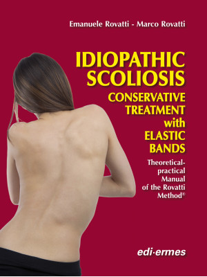 Idiopathic scoliosis. Conse...