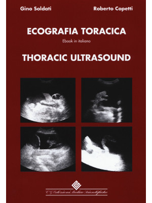 Thoracic ultrasound. Con ebook
