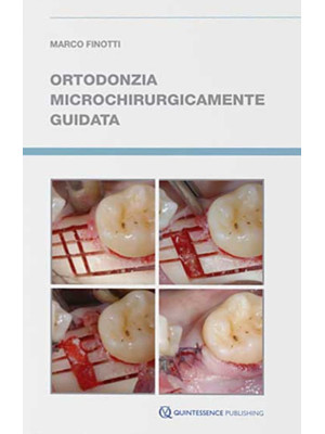 Ortodonzia microchirurgicam...