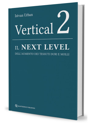 Vertical 2. Il next level d...