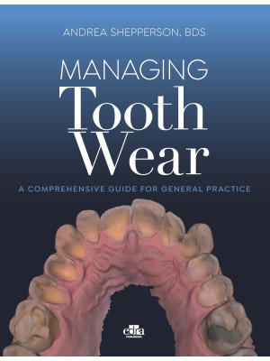 Managing tooth Wear. A comp...
