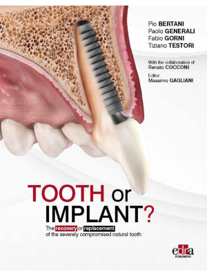 Tooth or Implant? The recov...
