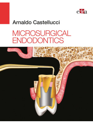 Microsurgical endodontics