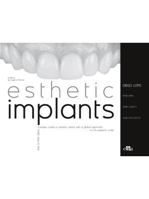 Esthetic implants. How to t...