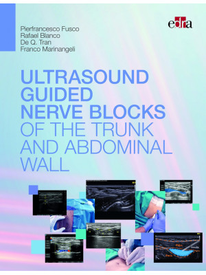 Ultrasound guided nerve blo...