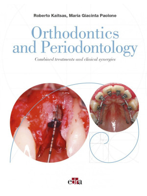 Orthodontics and Periodontology. Combined treatments and clinical synergies