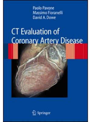 CT evaluation of coronary a...