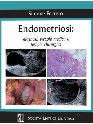Endometriosi: diagnosi, ter...