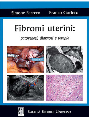 Fibromi uterini: patogenesi...