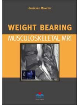 Weight bearing. Musculoskel...
