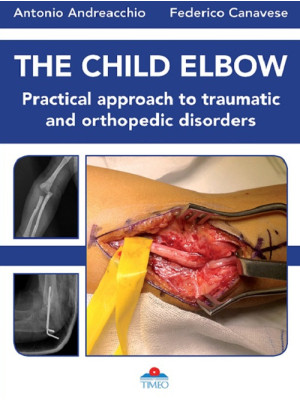 The child elbow. Practical ...
