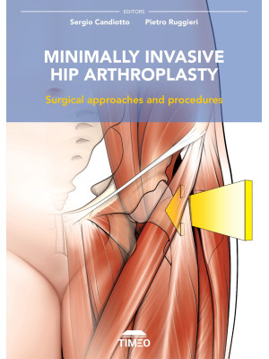 Minimally invasive hip arth...