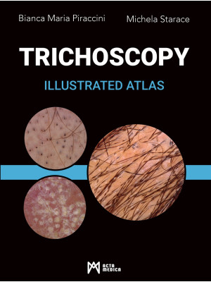 Trichoscopy. Illustrated at...