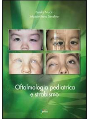 Oftalmologia pediatrica e s...