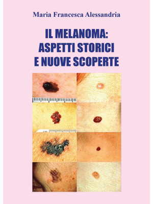 Il melanoma: aspetti storic...